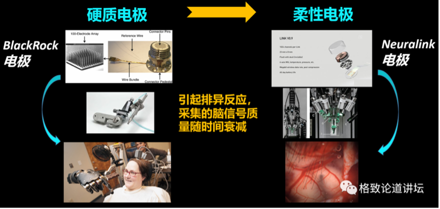 马斯克脑植入芯片_未来健康的新希望：马斯克宣布2025年Neuralink将为患者植入脑机设备_马斯克发明植入脑机接口