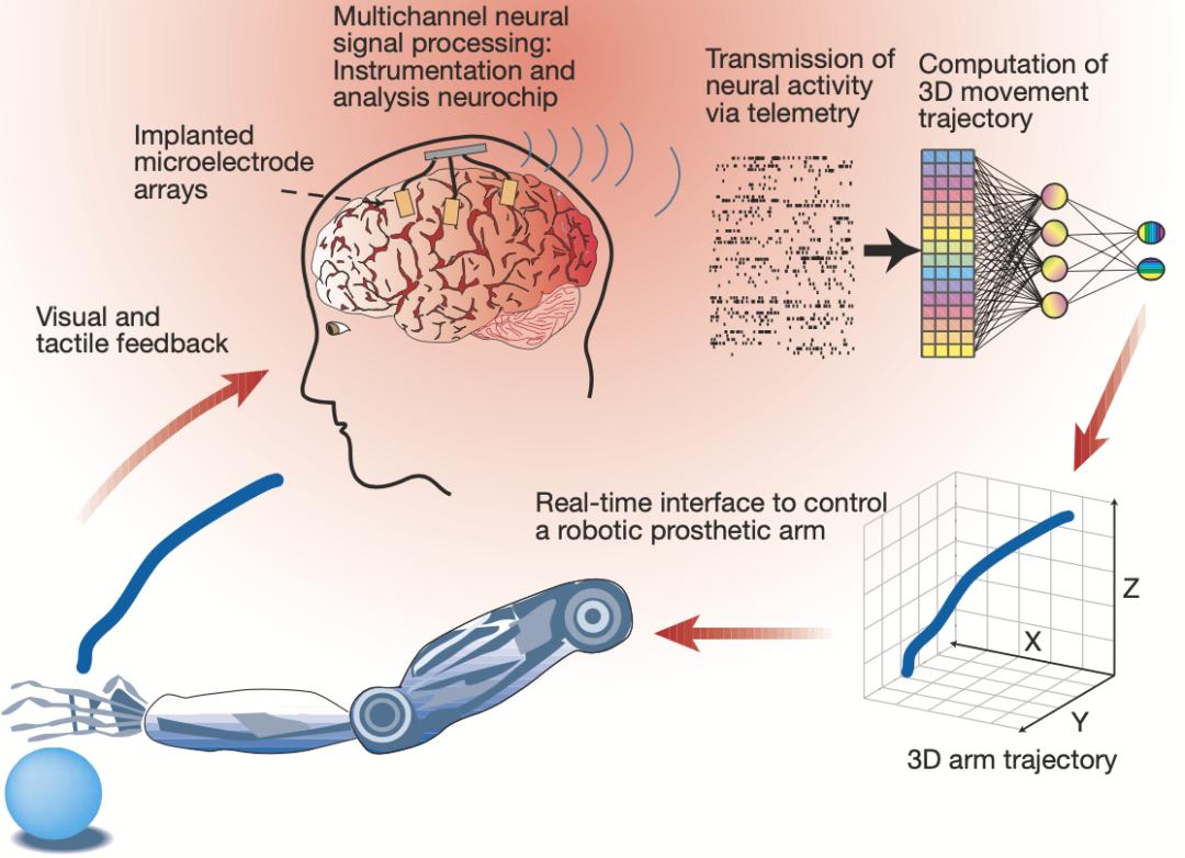 科技与医疗的完美结合：2025年Neuralink为20至30名患者植入脑机设备的可能性_技术植入_科幻作文600字脑植入芯片